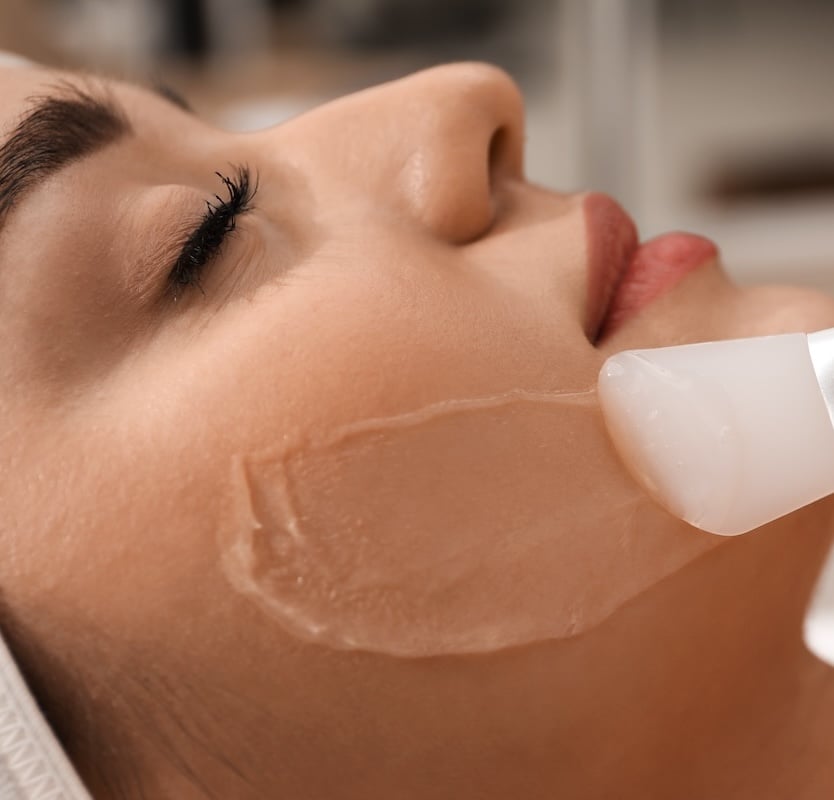 Chemical Peel Application